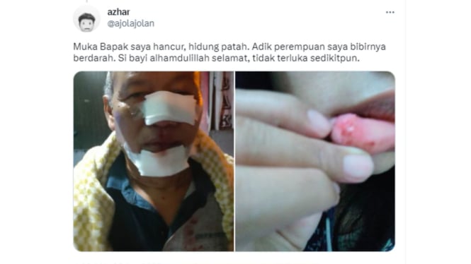 Wagra Nias Diduga Lakukan Pemukulan terhadap Satu Keluarga di Bogor Selatan
